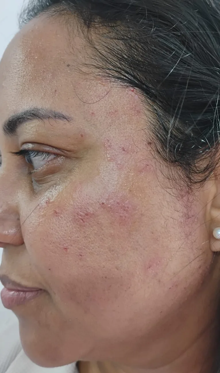 foto de nigras em lateral de face